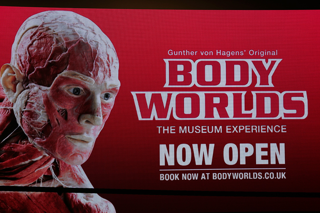 DÃ©couverte des entrailles de notre corps... Impressionnant !